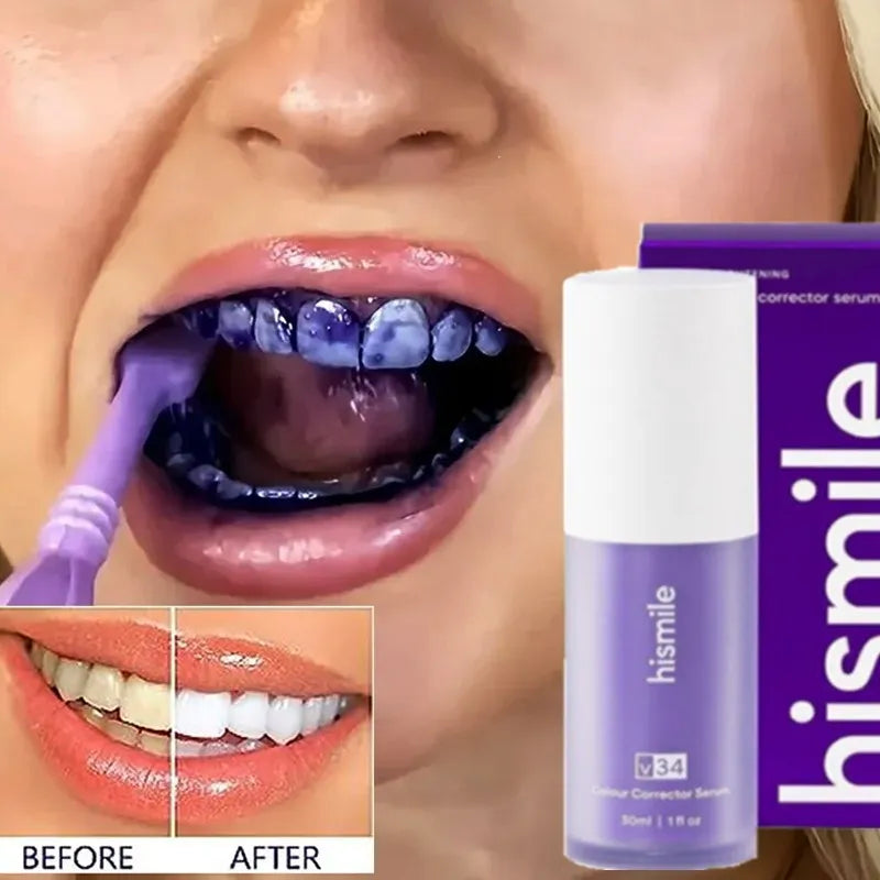 Hismile Crema Dental V34