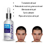 Serum Antiacne Bioaqua