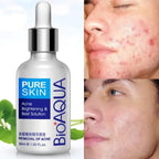 Serum Antiacne Bioaqua
