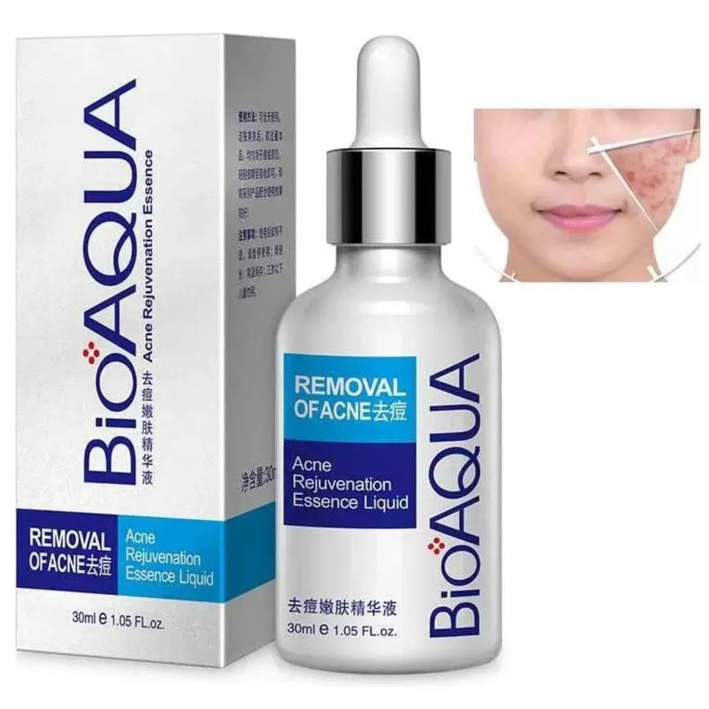 Serum Antiacne Bioaqua