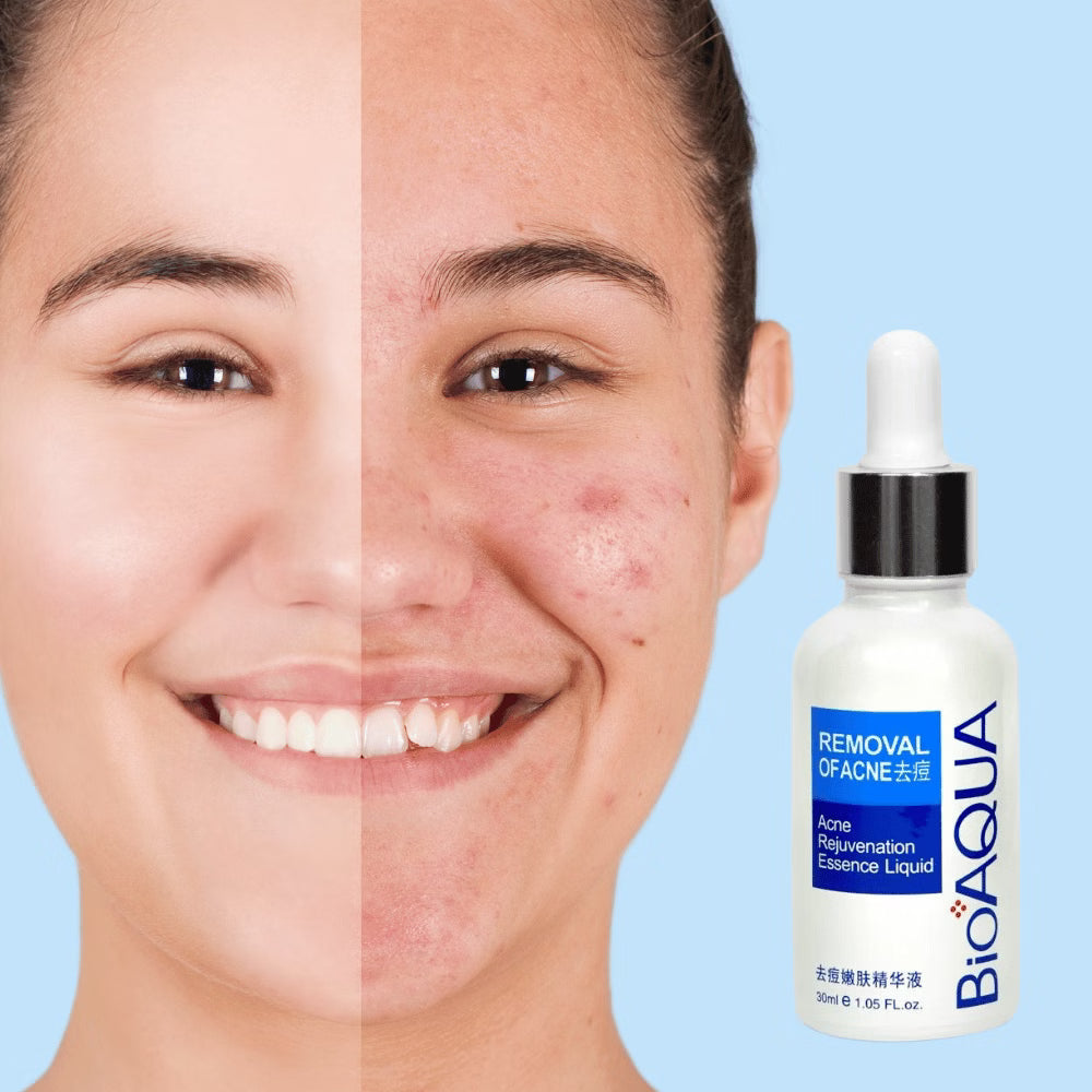 Serum Antiacne Bioaqua